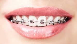 Orthodontics is a reputable dentistry
